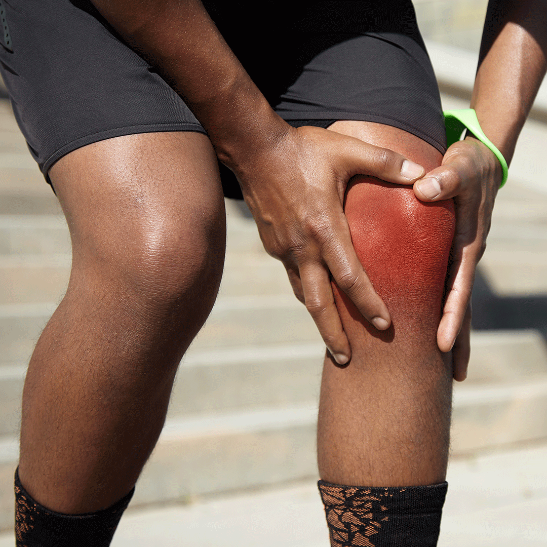 Arthritis Treatment in Jamaica
